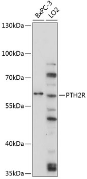 PTH2R Antibody