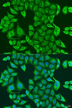 PDK2 Antibody