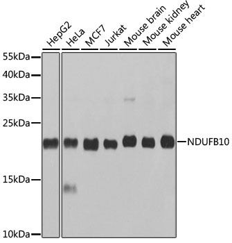 NDUFB10 Antibody