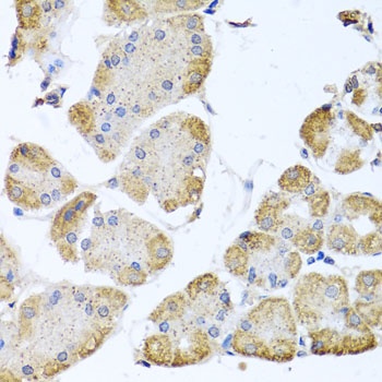 ITPKB Antibody