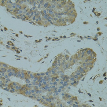 DGKQ Antibody