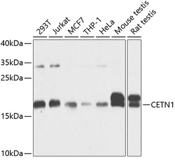 CETN1 Antibody