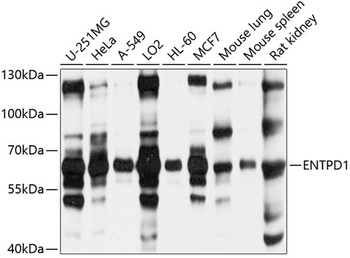 ENTPD1 Antibody