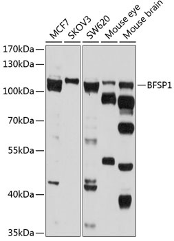 BFSP1 Antibody