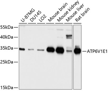 ATP6V1E1 Antibody