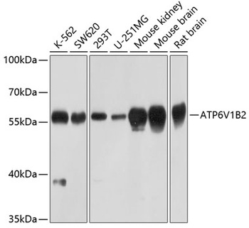 ATP6V1B2 Antibody