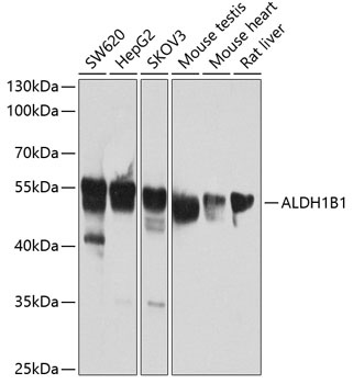 ALDH1B1 Antibody