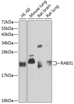 RAB31 Antibody