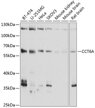 CCT6A Antibody