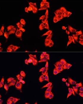 ARHGAP5 Antibody