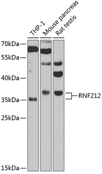 RNF212 Antibody