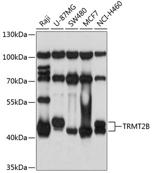 TRMT2B Antibody