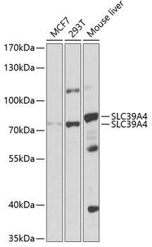 SLC39A4 Antibody