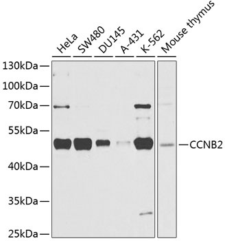 CCNB2 Antibody
