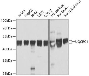 UQCRC1 Antibody