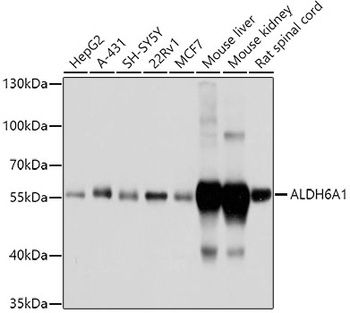 ALDH6A1 Antibody