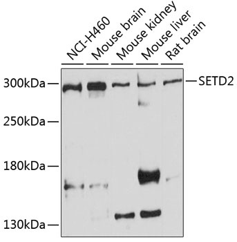 SETD2 Antibody