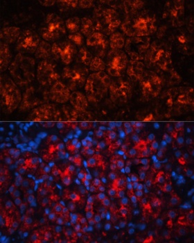 LCN2 Antibody