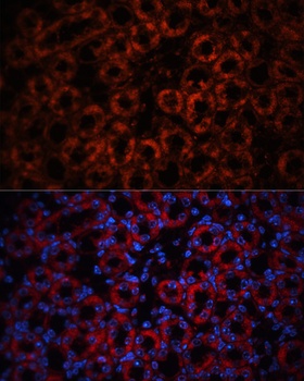 LCN2 Antibody