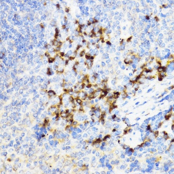 CHI3L1 Antibody