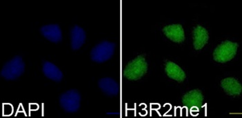 H3R2me1 Antibody