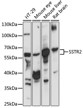 SSTR2 Antibody