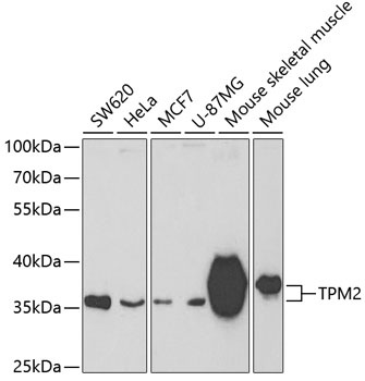 TPM2 Antibody