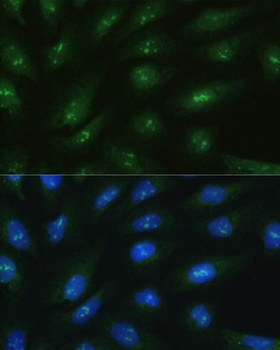 RAD50 Antibody