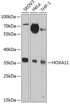 HOXA11 Antibody
