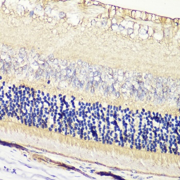 GRK1 Antibody