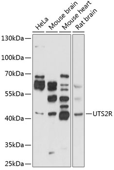 UTS2R Antibody