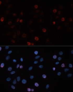DNMT3B Antibody