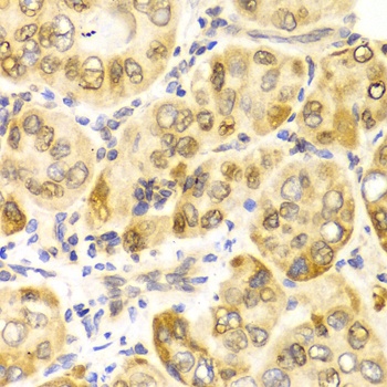 CPT2 Antibody