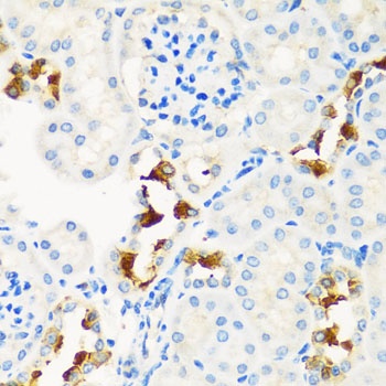 CPT2 Antibody