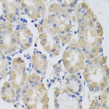 GPT Antibody