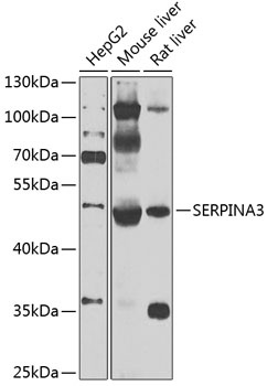 SERPINA3 Antibody