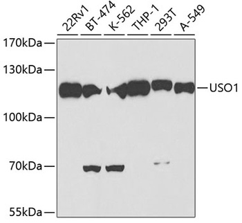 USO1 Antibody