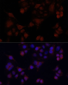 MAPRE1 Antibody