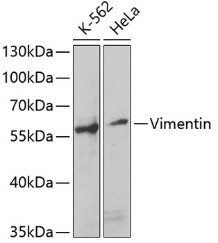 VIM Antibody