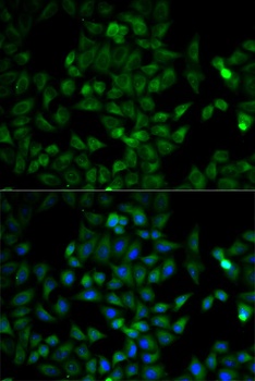 TPI1 Antibody