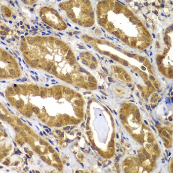 MMP14 Antibody