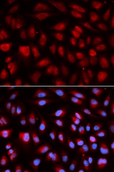 PLK1 Antibody