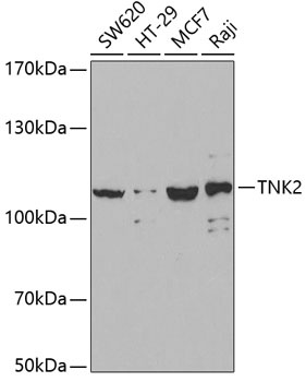 TNK2 Antibody