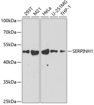 SERPINH1 Antibody