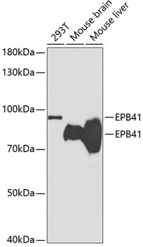 EPB41 Antibody