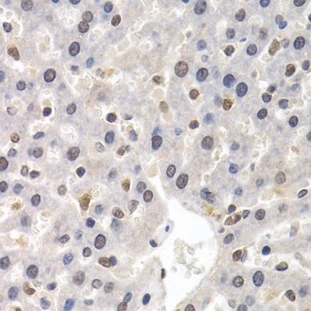 GTF2F1 Antibody