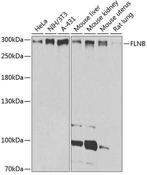 FLNB Antibody