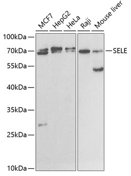 SELE Antibody