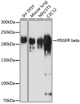 PDGFRB Antibody