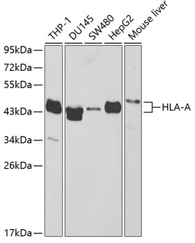 HLA-A Antibody